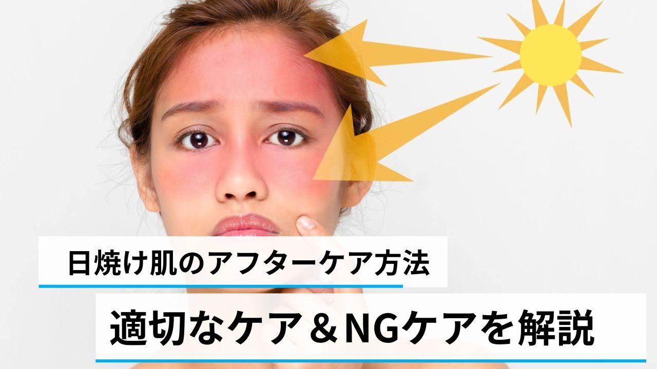 日焼けと美白ケア