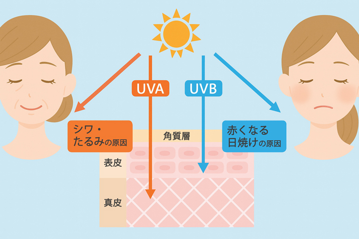 UVBの影響を説明する画像